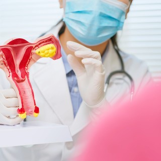 PCOS-re fogamzásgátló: mi működhet még, ha a családtervezés a tét? című cikk nyitóképe