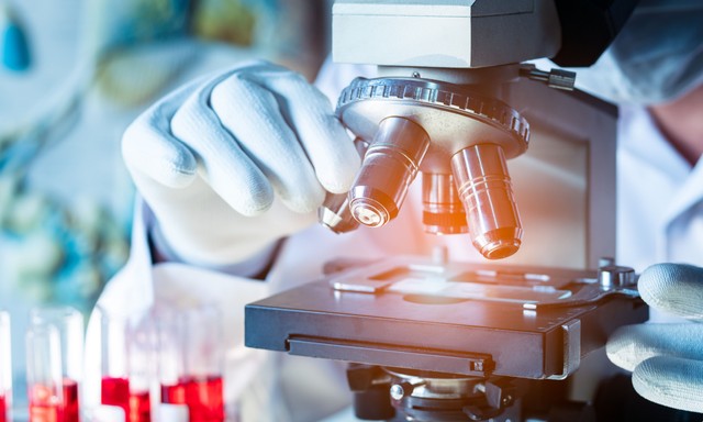 Rákmegelőzés: nem elég az egészséges életmód, ezt is meg kell lépni!