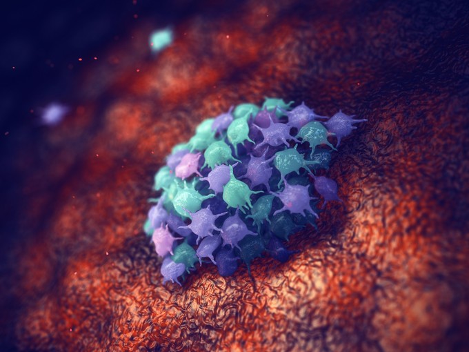 Alacsony vérlemezkeszám: ez az érték már leukémiára utalhat című cikk nyitóképe