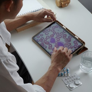 Mit kell tudni a leukémia stádiumairól? Ezt jelentik valójában a stádiumok című cikk nyitóképe