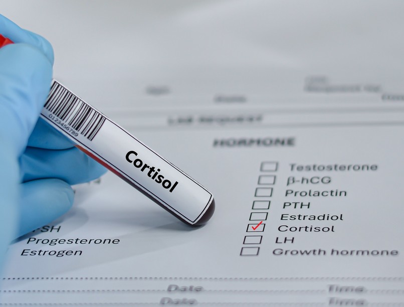 kortizol szint mi számít magasnak
