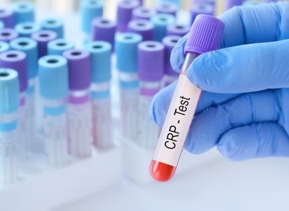 Egy szám a leleten, ami sokat elárul: miért lehet magas a CRP? című cikk nyitóképe