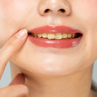 6 étel és ital, amitől elszíneződhetnek a fogai című cikk nyitóképe