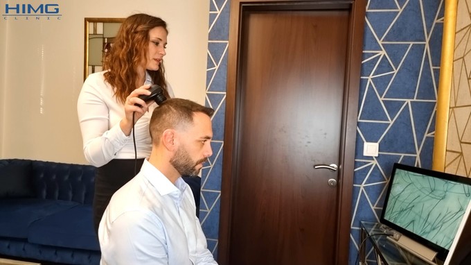 Mikor lesz látható a végleges eredmény a hajbeültetés után? című cikk nyitóképe