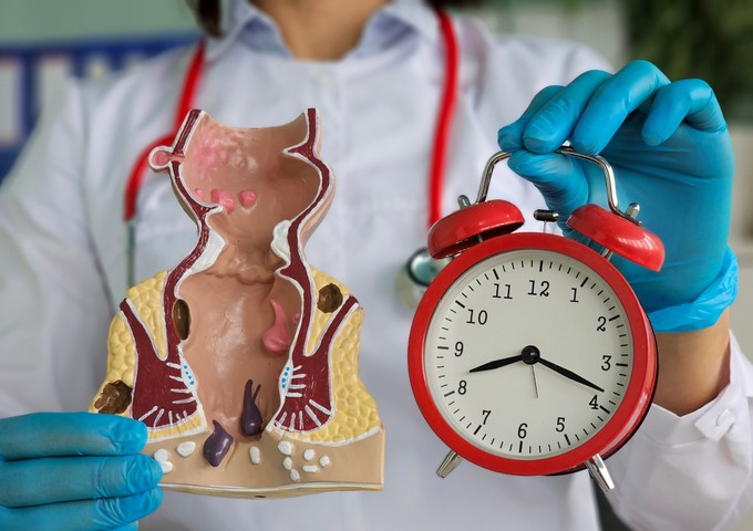 Szorító gondok, végbél panaszok – ilyen problémák lehetnek mögötte című cikk nyitóképe