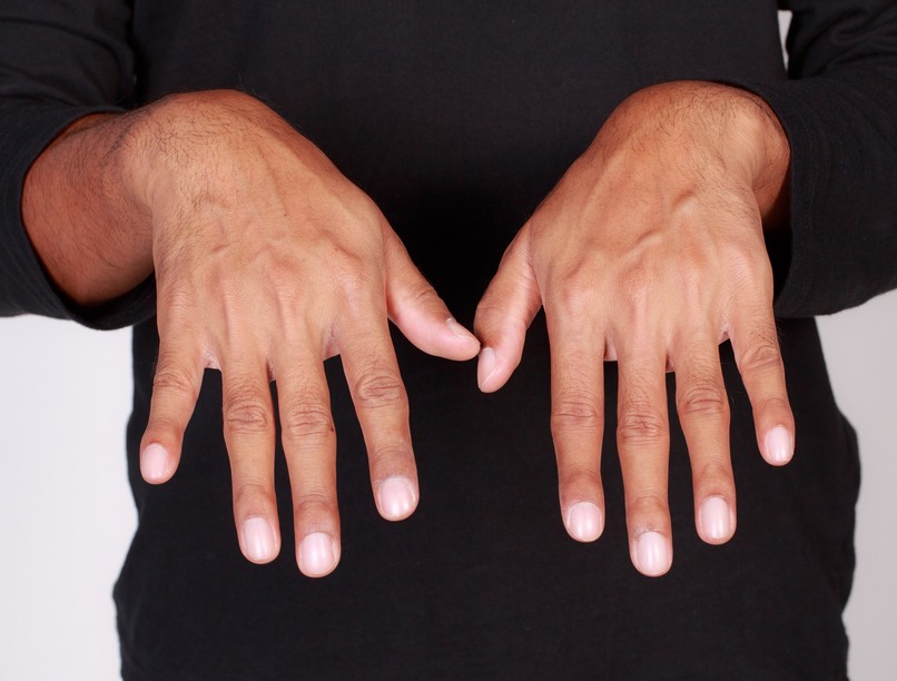 mit jelent a fehér, opálos érdes köröm máj betegség