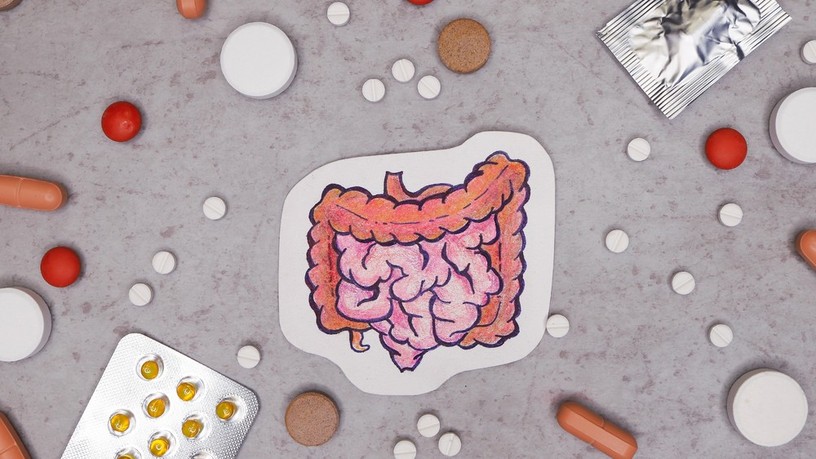 vastagbélrák, antibiotikum, bélflóra, daganat