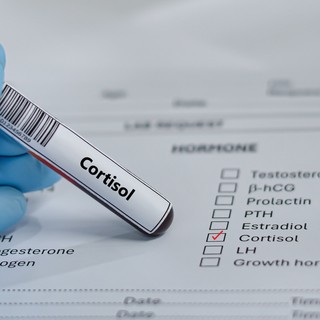 Mi számít magas kortizol szintnek? Nézze meg, érintett-e! című cikk nyitóképe