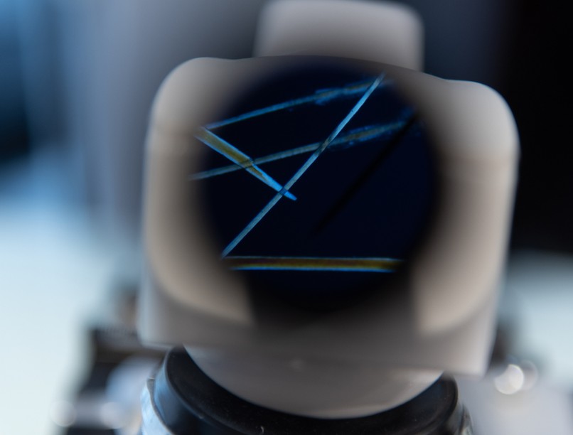 nehézfém, hajszál, analitika, nehézfém mérgezés