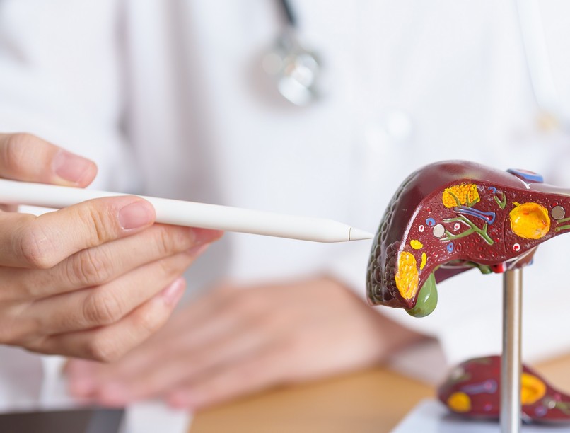 májrák májáttét tünet, különbség