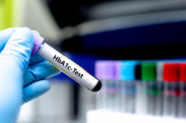 HbA1c, a cukorbetegek időgépe: miért kell ellenőrizni, és miért nehéz néha beállítani?