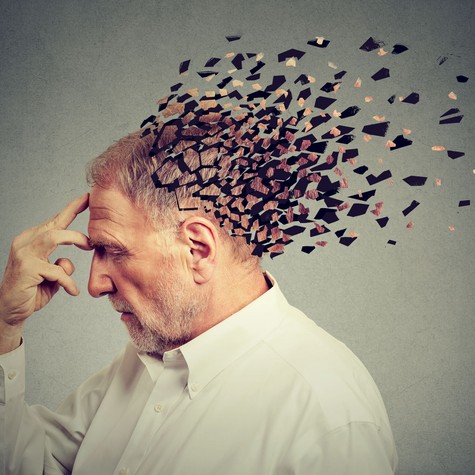 Az Alzheimer-kór korai jelei, amelyeket sokan figyelmen kívül hagynak – neurológusok figyelmeztetnek című cikk nyitóképe