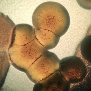 Halálos szuperbaktériumot fedeztek fel, amely orvosi műanyagon lakmározik című cikk nyitóképe