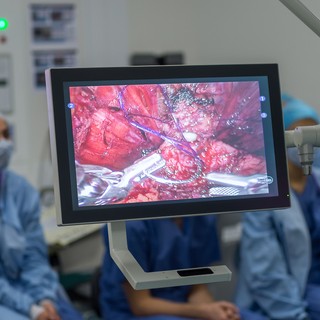 Mi az endoszkópos kezelés? című cikk nyitóképe