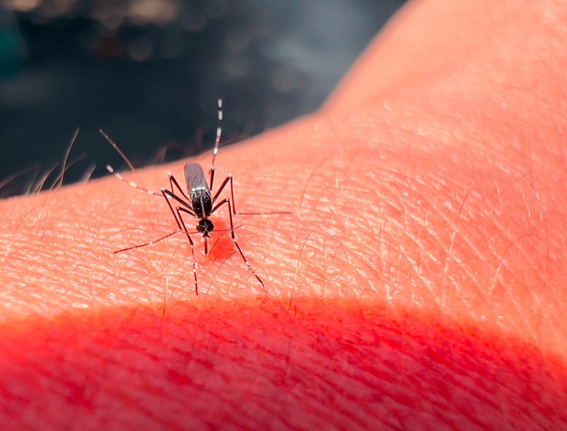 Sárgaláz tünet izsgálat kezelés