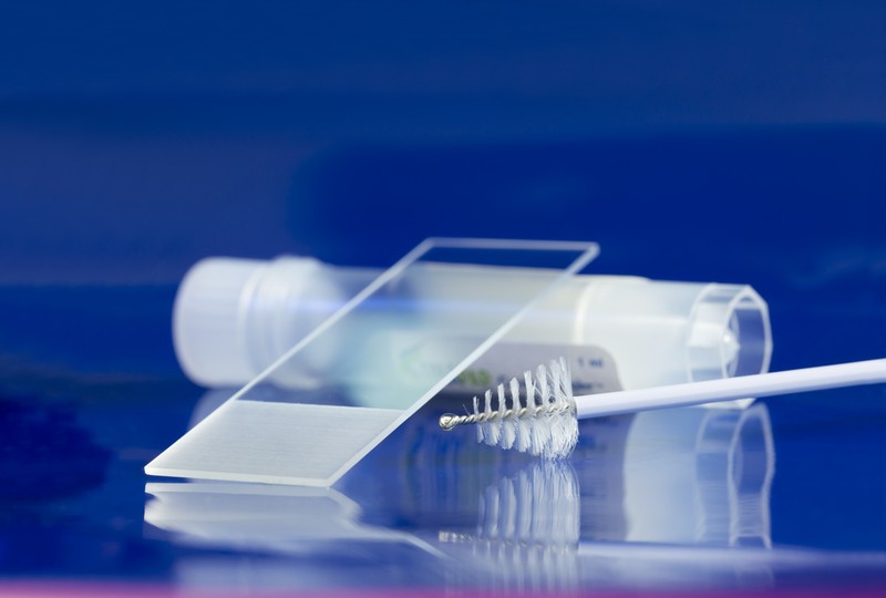 Két módszer, amit bármikor bevethet a méhnyakrák ellen