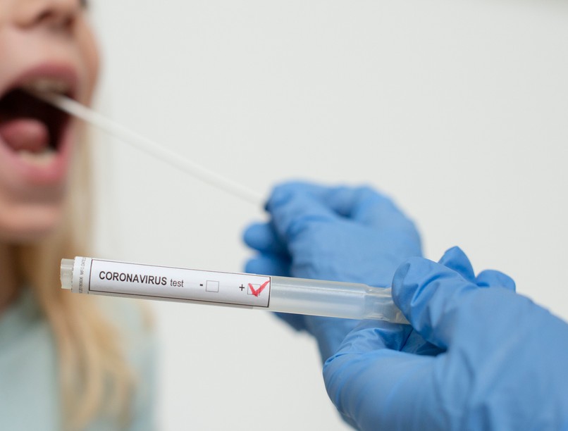 koronavírus, covid, omikron, pcr-teszt