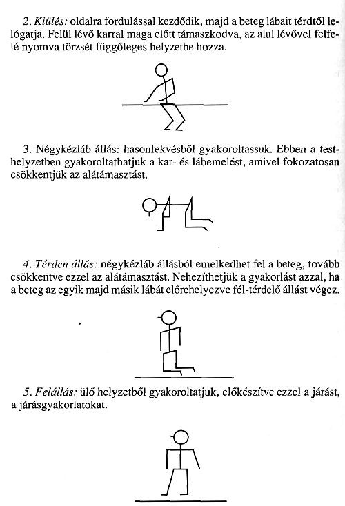 Stroke: a betegápolás speciális szempontjai: mozgatás, önálló mozgások