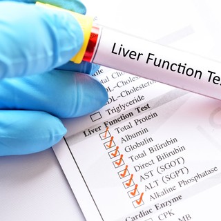 Ezek a laborértékek utalhatnak a máj zavaraira - tudja meg, miket kell nézni! című cikk nyitóképe