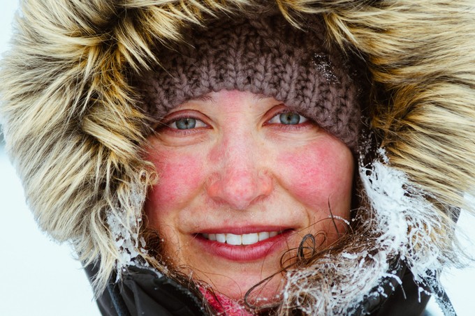 Miért pirosodik ki az arcunk, amikor melegünk van vagy fázunk? című cikk nyitóképe