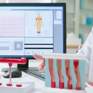 Mennyire vihető le a magas koleszterin természetesen, tudatos étkezéssel? Közel sem annyira, mint azt sokan hiszik! című cikk nyitóképe