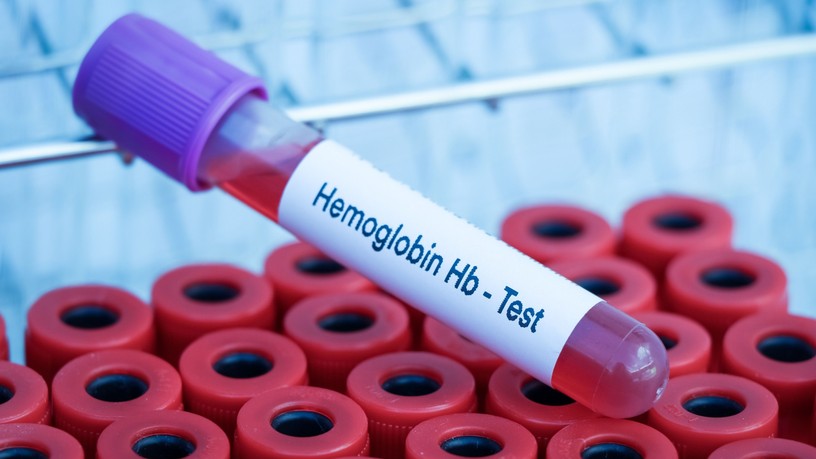 hemoglobin alacsony mikor veszélyes vérvétel vértranszfúzió