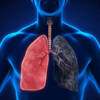 Megdöbbentően gyorsan eljuthatunk az első slukktól a COPD betegségig című cikk nyitóképe