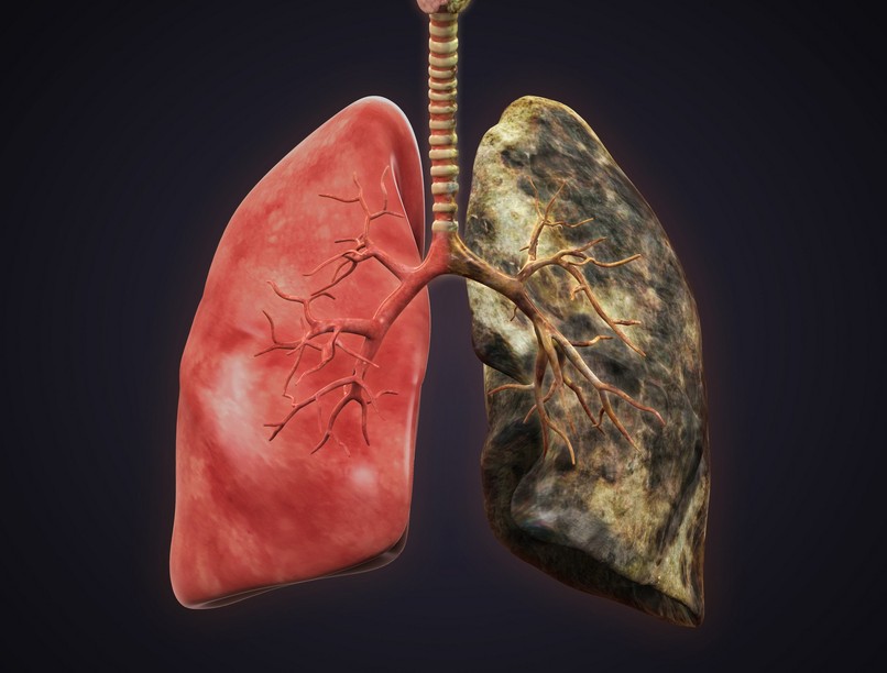 dohányzás, tüdőrák, nikotin, veserák