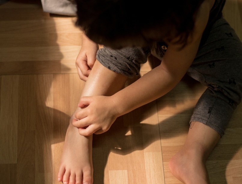 gyerek, ekcéma, kiütés, viszketés, bőrbetegség