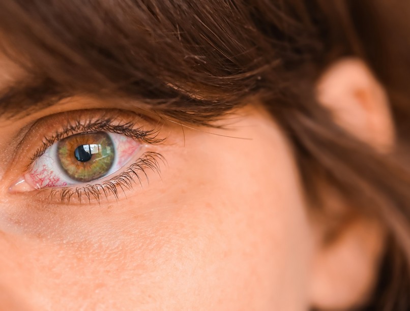 szemszárazság ellen mi jó szemjóga 