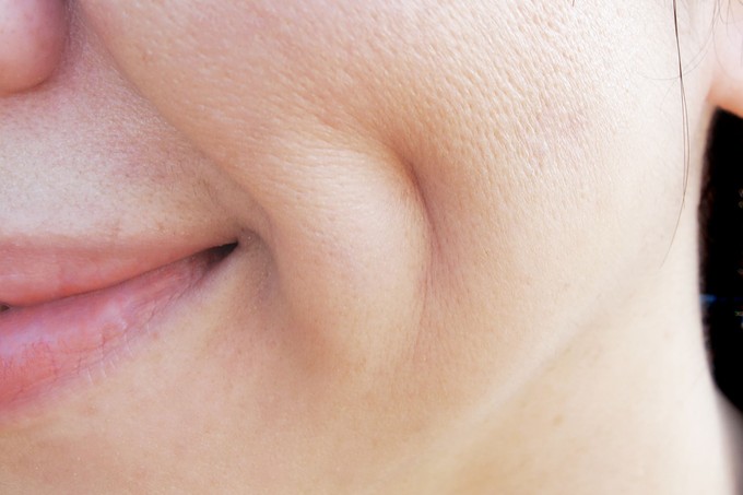 Miért vannak egyeseknek születésük óta gödröcskék az arcukon – és mit üzen ez a különleges vonás? című cikk nyitóképe