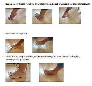 Gyógytornák: hogyan kezelhető a bütyök?