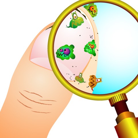 A Covid-köröm egyre gyakoribb tünetként jelentkezik azoknál, akik átestek a koronavíruson. A jelenség oka, hogy a fertőzés hatással van a körömnövekedésre is, ami a gyógyulás után helyreáll, ennek pedig nyoma marad.