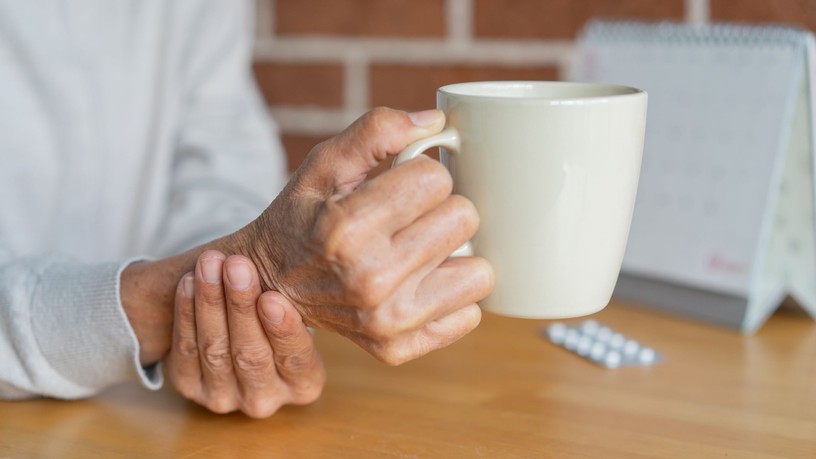 parkinson kor, gazdaság munkaerőpiac