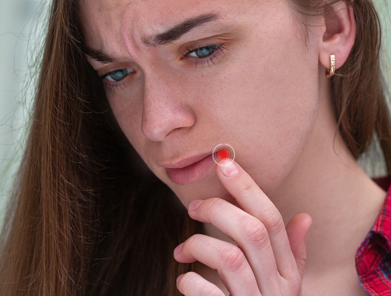 herpesz, ajakherpesz, oka, kezelése