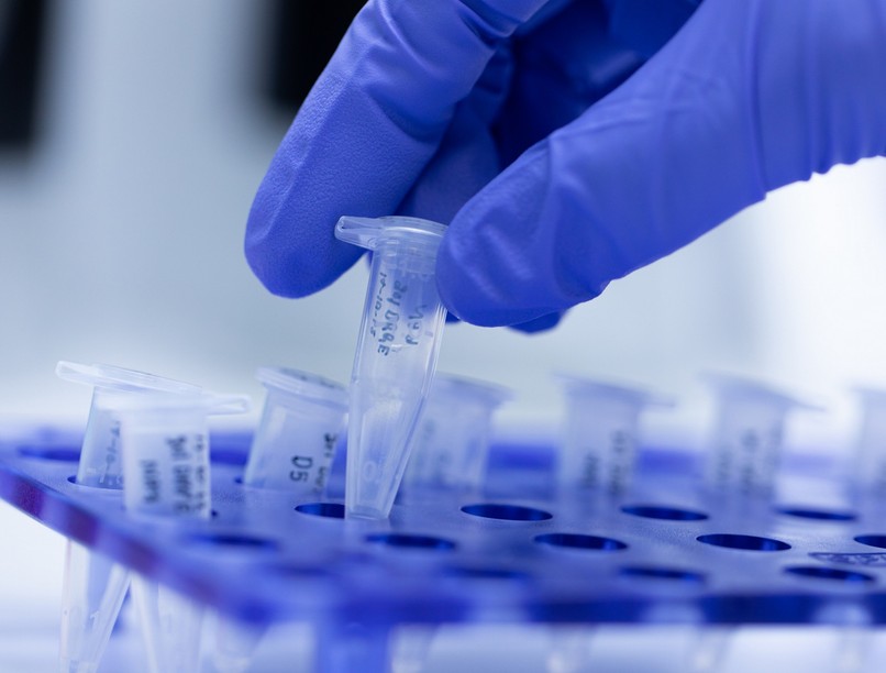 járvány, szűrés, elte, covid