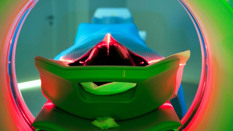 sugárkezelés radioterápia kezelés leírás