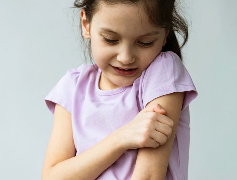 gyerek, viszketés, csalánkiütés