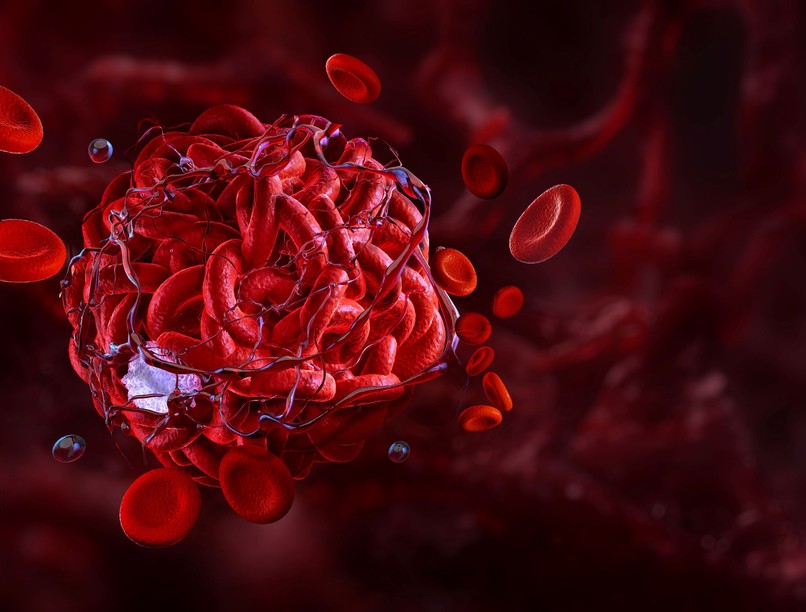 trombózis vérrög ellen véralvadásgátló terápia