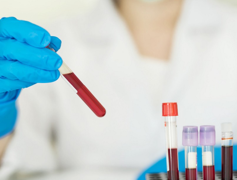 vérvizsgálat lelet mit jelent