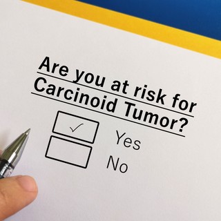 Karcinoid tumorok: tünetek, okok, kezelési lehetősgek című cikk nyitóképe