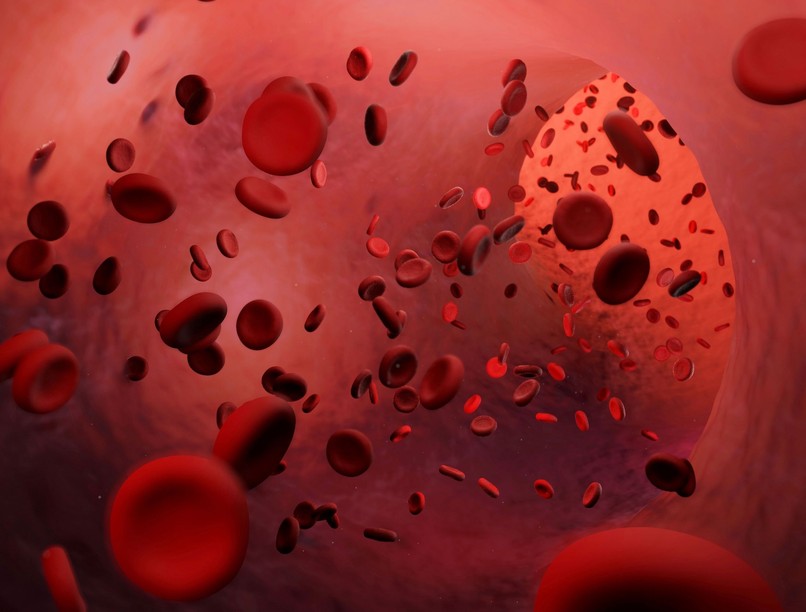 zsibbadás beszédzavar oka jele agyvérzés stroke tünete