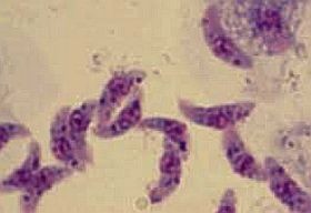 Fertőzések - terhesség idején