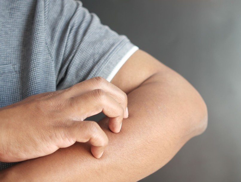 májkárosodás tünetei bőr sárgaság