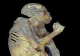 Ókori prosztatarák - és a genetika