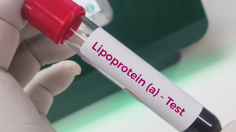 ldl-koleszterin, lipoprotein örökletes kezelés