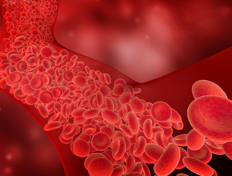 Esszenciális trombocitémia, trombózis, vérrög