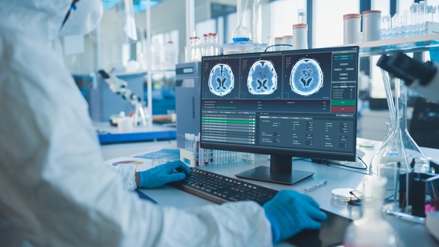 Hónapokig szivárgott az agyvize egy férfinak a Covid-teszt után