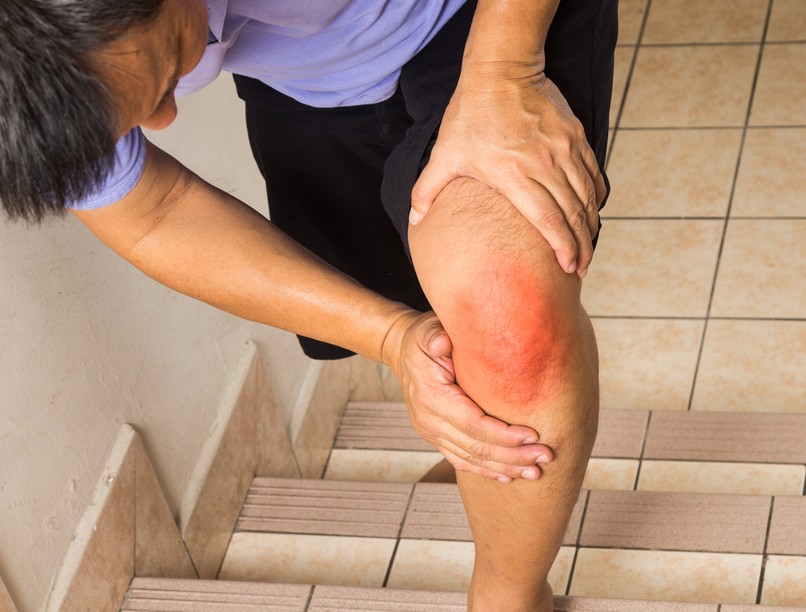 porckopás, térdfájás, lépcsőzés, fájdalom