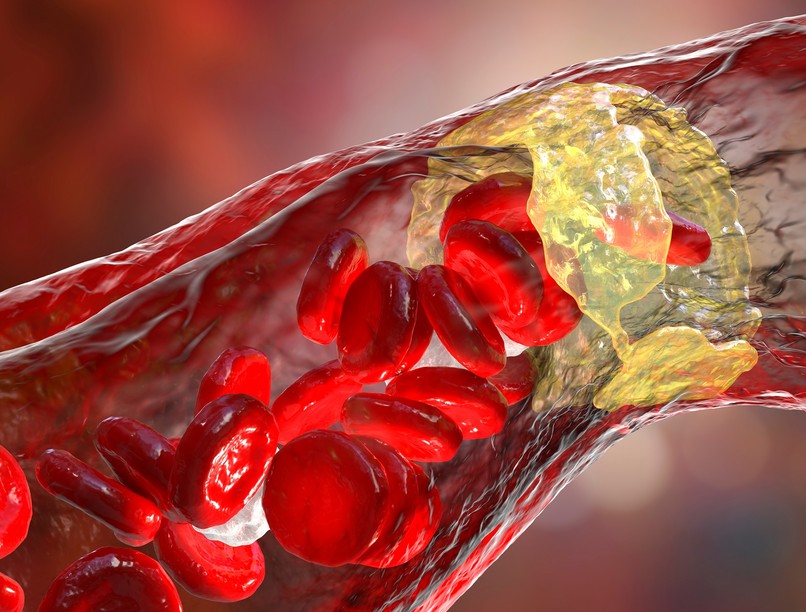 magas koleszterin szint ellen szója kutatás